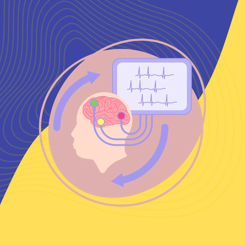 Transcranial Direct Current Stimulation Therapy( TDCS)